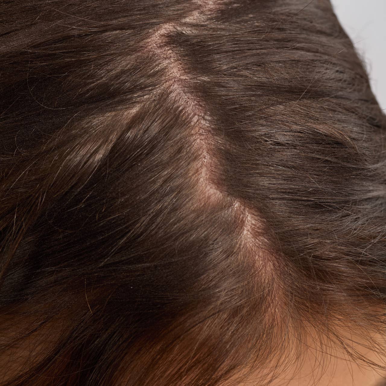 Strengthening Hair & Scalp Oil | KITSCH